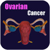 Ovarian Cancer II