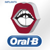 Dental Implants - by Oral-B