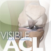 Visible ACL