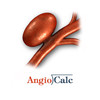 AngioCalc