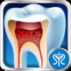 Surgery Squad's Virtual Root Canal Procedure