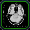 MRI-Xray Human Body