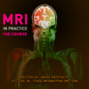 MRI in Practice App 03a - Phase Mismapping