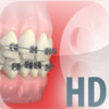 Dentapedia HD (Orthodontics)