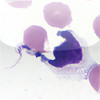 Histology Images - Blood-borne Parasites