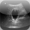 ARDMS Abdomen Ultrasound Flashcards for Board Review