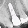 Dental Radiographs