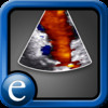 Echocardiography Atlas by Epocrates, edited by Scott D. Solomon, MD