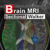 BrainMRISectionalWalker