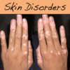 Most Skin Disorders