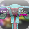 Females Reproductive Tumors