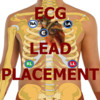 ECG Lead Placement