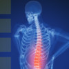 Back Pain Nerve Chart