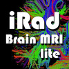 iRad Brain MRI Lite