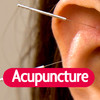 Acupuncture St