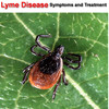 Lyme Disease +