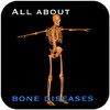 All About Bone Diseases