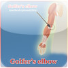 Golfers Elbow Animated Exercises