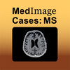 Multiple Sclerosis - MedImage Cases