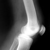 Ache Ortopedia e traumas do esporte joelho