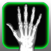 X-Ray Scanner for iPhone
