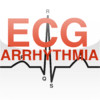 ECG ARRHYTHMIA