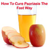 Psoriasis: How To Cure Psoriasis The Fast Way!