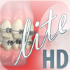Dentapedia HD (Orthodontics) Lite