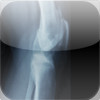 Arthritis Joint Pain Relief
