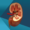 Kidney Urology - Simulations and behaviors of Kidney diseases