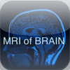 MRI of Brain