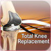 Total Knee Replacement Exercises