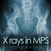 X rays in MPS