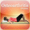 Osteoarthritis of knee